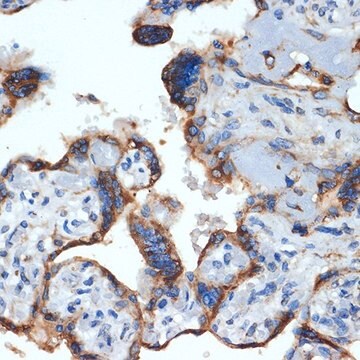 Anti-NLK antibody produced in rabbit