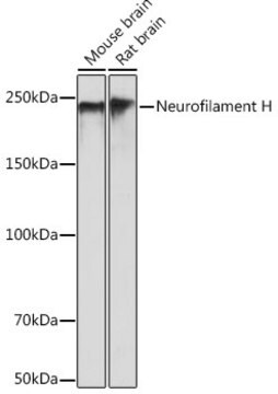 Przeciwciało przeciw neurofilamentowi H, klon 7L2V7, królicze monoklonalne