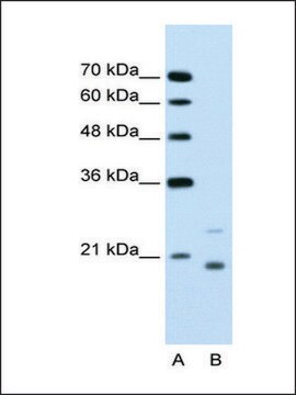 Anti-UBE2D1 antibody produced in rabbit IgG fraction of antiserum