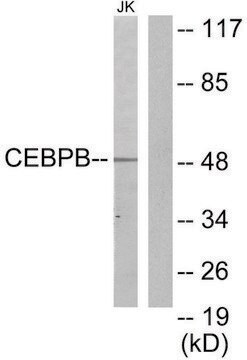 Anti-CEBPB antibody produced in rabbit affinity isolated antibody