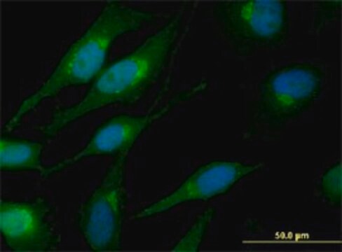 Monoclonal Anti-CTNNB1 antibody produced in mouse clone 1C9, purified immunoglobulin, buffered aqueous solution