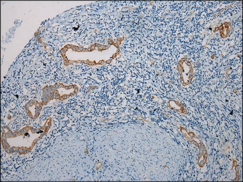 Anti-TRIM62 affinity isolated antibody