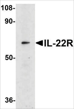 Anti-IL-22 Receptor antibody produced in rabbit affinity isolated antibody, buffered aqueous solution