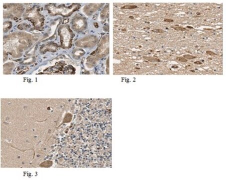 Anti-EPAC1 Antibody from rabbit, purified by affinity chromatography