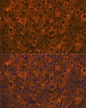 Anti-SULT2A1 Antibody, clone 4A3H6, Rabbit Monoclonal