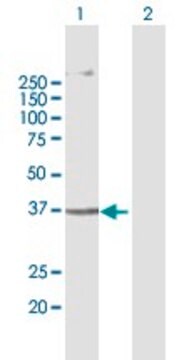 Anti-AGPAT5 antibody produced in mouse purified immunoglobulin, buffered aqueous solution