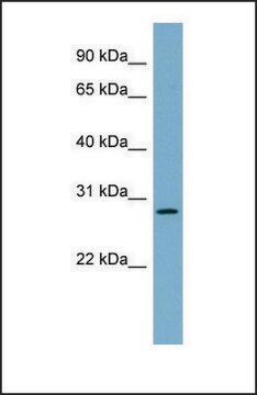 Anti-DNAJB9, (N-terminal) antibody produced in rabbit affinity isolated antibody