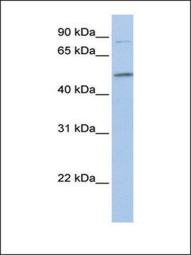 Anti-FAM20C (AB2) antibody produced in rabbit affinity isolated antibody