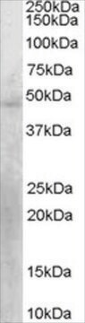 Anti-KLF15 antibody produced in goat affinity isolated antibody, buffered aqueous solution