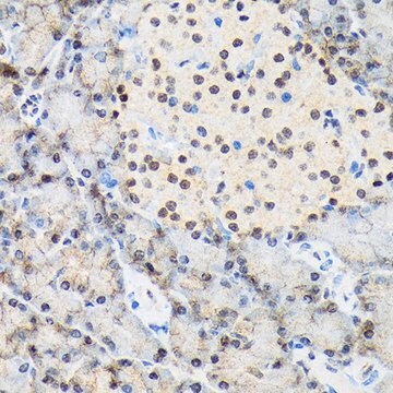 Anti-TARBP2 antibody produced in rabbit