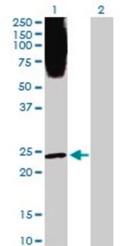 Anti-PLA2G1B antibody produced in rabbit purified immunoglobulin, buffered aqueous solution