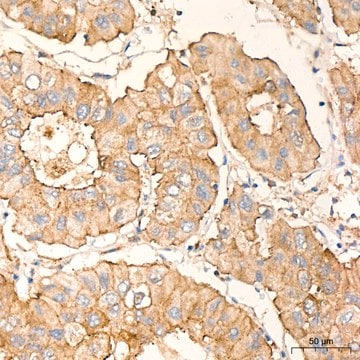 Anti-PKC alpha Antibody, clone 1G10S8, Rabbit Monoclonal