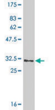 Monoclonal Anti-GGTLA1, (C-terminal) antibody produced in mouse clone 3E10, ascites fluid