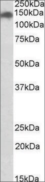 Anti-SMC2 (C-terminal) antibody produced in goat affinity isolated antibody, buffered aqueous solution