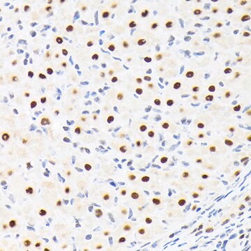 Anti-SUPT5H/SPT5 Antibody, clone 9V9G7, Rabbit Monoclonal