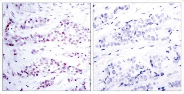 Anti-STAT6 (Ab-641) antibody produced in rabbit affinity isolated antibody