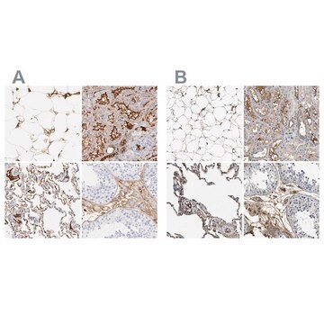 Anti-C3 antibody produced in rabbit Prestige Antibodies&#174; Powered by Atlas Antibodies, affinity isolated antibody, buffered aqueous glycerol solution