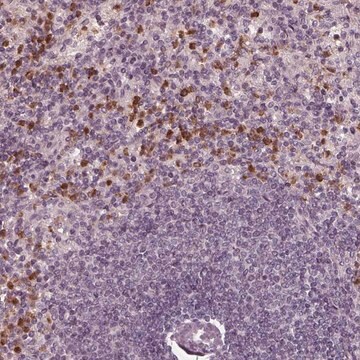 Anti-CHIT1 antibody produced in rabbit Prestige Antibodies&#174; Powered by Atlas Antibodies, affinity isolated antibody, buffered aqueous glycerol solution