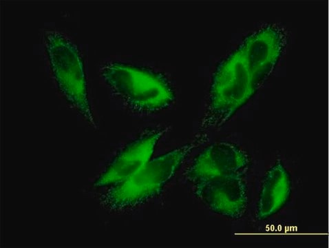 Anti-EPHX1 antibody produced in mouse purified immunoglobulin, buffered aqueous solution