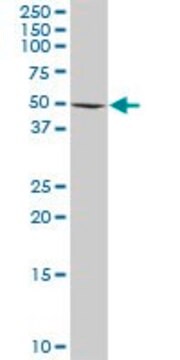 Anti-RAD18 antibody produced in rabbit purified immunoglobulin, buffered aqueous solution