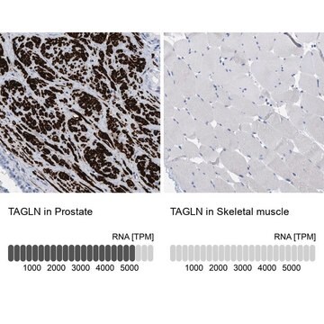 抗TAGLN抗体 ウサギ宿主抗体 affinity isolated antibody, buffered aqueous glycerol solution