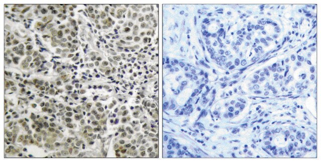 抗アンドロゲンレセプター抗体 ウサギ宿主抗体 affinity isolated antibody