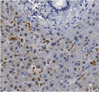 Anti-Dihydropyrimidin-Dehydrogenase/DPYD-Antikörper from rabbit, purified by affinity chromatography