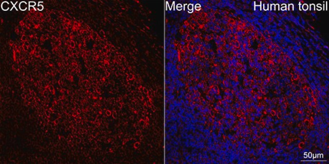 Anti-CXCR5 Antibody, clone 9Q10I2, Rabbit Monoclonal