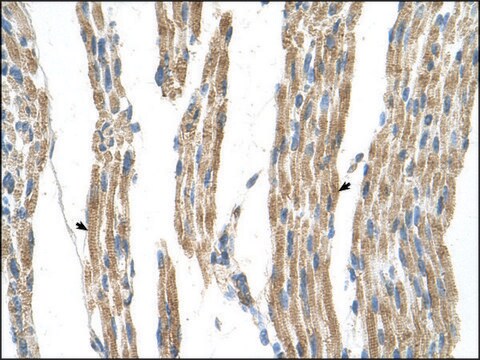 Anti-GPT (AB1) antibody produced in rabbit IgG fraction of antiserum