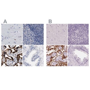 Anti-HSD17B1 antibody produced in rabbit Prestige Antibodies&#174; Powered by Atlas Antibodies, affinity isolated antibody, buffered aqueous glycerol solution