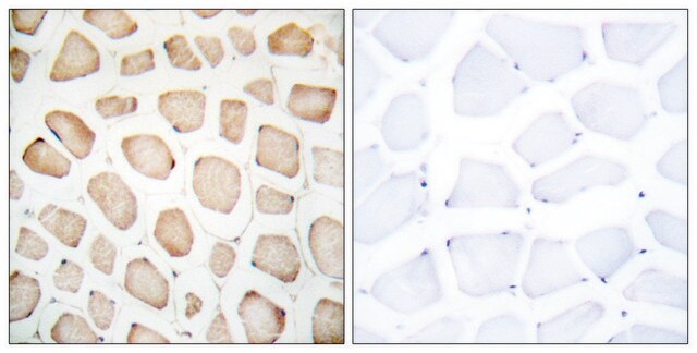 Anti-CHOP, N-Terminal antibody produced in rabbit affinity isolated antibody