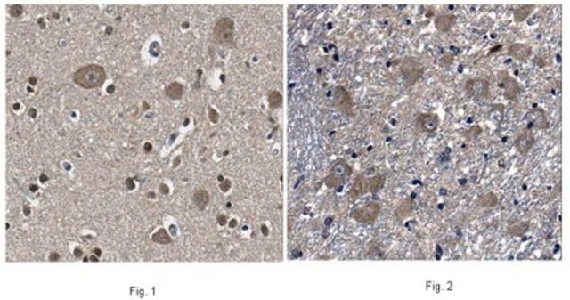 Anti-Amyloid-like protein 1 Antibody from rabbit, purified by affinity chromatography