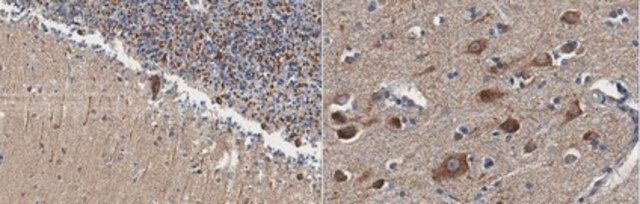 Anti-Alpha 2b Adrenergic Receptor from rabbit, purified by affinity chromatography