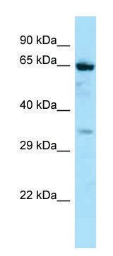 Anti-NOX5 (C-terminal) antibody produced in rabbit affinity isolated antibody