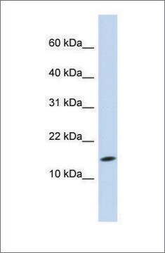 抗UBE2D3 ウサギ宿主抗体 affinity isolated antibody