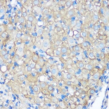 Anti-CD23 antibody produced in rabbit