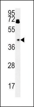 ANTI-BDHA1 (CENTER) antibody produced in rabbit affinity isolated antibody, buffered aqueous solution