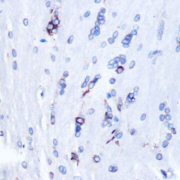 Anti-YB-1/YBX1 antibody produced in rabbit