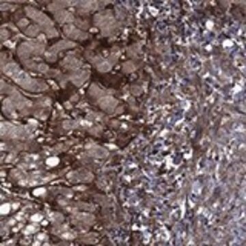 Anty-COL18A1 Prestige Antibodies&#174; Powered by Atlas Antibodies, affinity isolated antibody, buffered aqueous glycerol solution