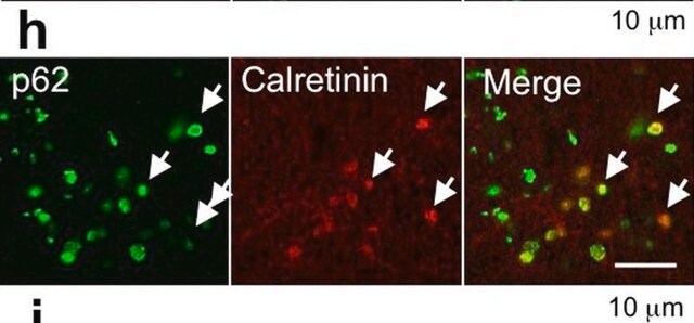 Anticorpo anti-calretinina, clone 6B8.2 clone 6B8.2, Chemicon&#174;, from mouse