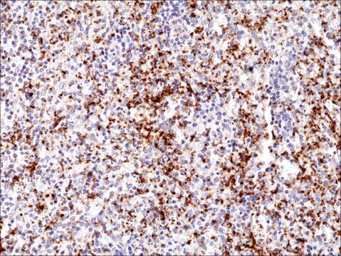 Anti-Integrin beta3/CD61 antibody, Rabbit monoclonal recombinant, expressed in HEK 293 cells, clone RM382, purified immunoglobulin