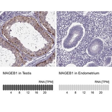 ANTI-MAGEB1 antibody produced in rabbit Prestige Antibodies&#174; Powered by Atlas Antibodies, affinity isolated antibody, buffered aqueous glycerol solution