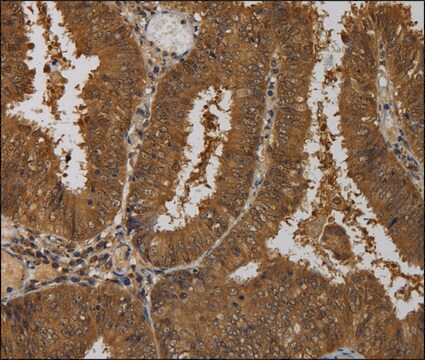 Anti-TAB1 antibody produced in rabbit affinity isolated antibody