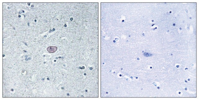 Anti-VEGFR2 antibody produced in rabbit affinity isolated antibody