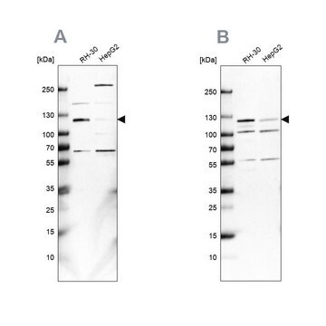 Anty-USP1 Prestige Antibodies&#174; Powered by Atlas Antibodies, affinity isolated antibody