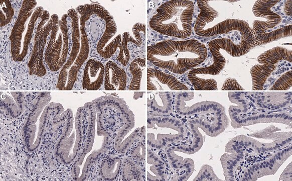 Anti-Extrahepatic biliary cells Antibody, clone GB5