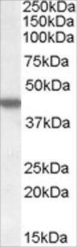 Anti-CSNK1E antibody produced in goat affinity isolated antibody, buffered aqueous solution