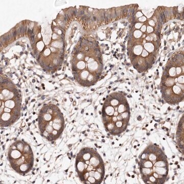 Anti-PANK4 antibody produced in rabbit Prestige Antibodies&#174; Powered by Atlas Antibodies, affinity isolated antibody, buffered aqueous glycerol solution