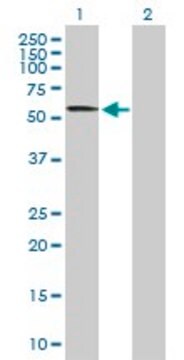 Anti-CACNB4 antibody produced in mouse purified immunoglobulin, buffered aqueous solution