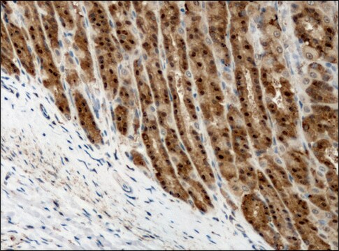 抗デストリン/ADF (GV-13)抗体 ウサギ宿主抗体 affinity isolated antibody, buffered aqueous solution